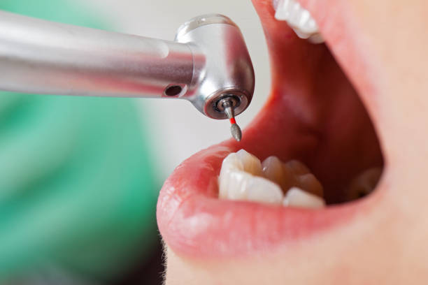 Best Pediatric Emergency Dentist in Boiling Spring Lakes, NC